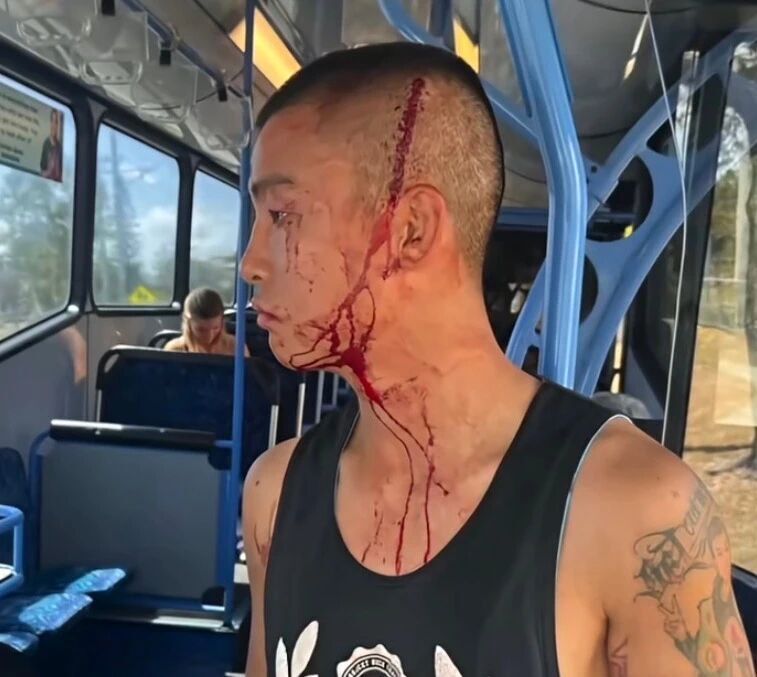 子在澳大利, 严重创伤 子在澳大利, 严重创伤